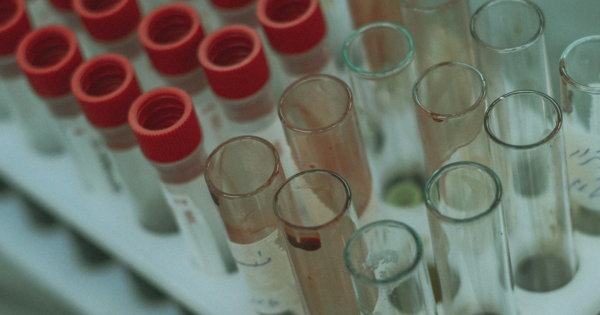 Anti-TPO antibodies: what the test shows and why it matters for athletes