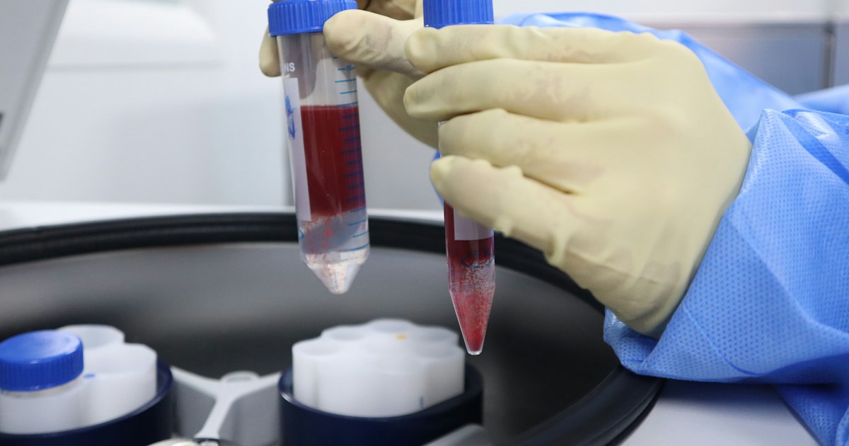 Urinalysis above or below normal: causes in athletes and what to do